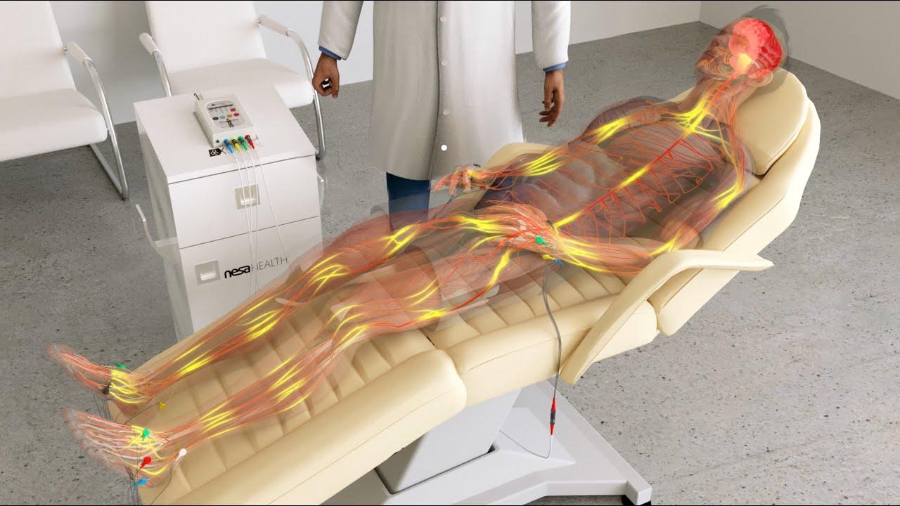 «Neuroestimulación no invasiva: tecnología de vanguardia en Sonríe a la Vida»
