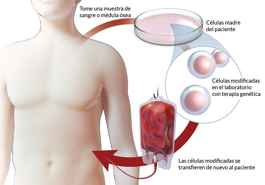Terapias génicas: una revolución en el tratamiento de enfermedades