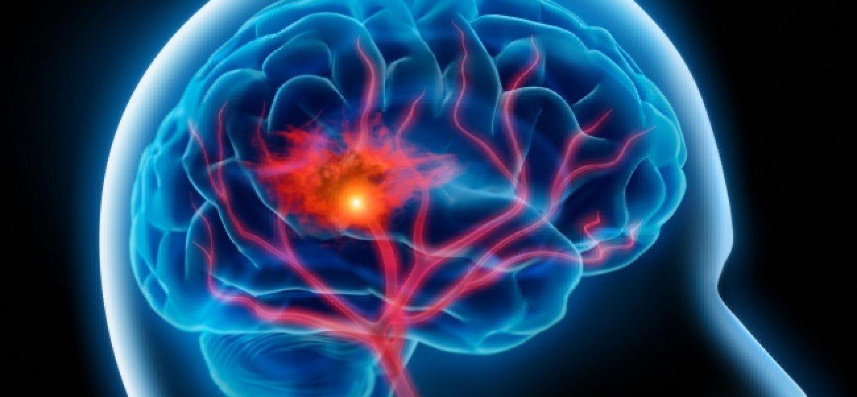 Beneficios de la neuroprotección natural